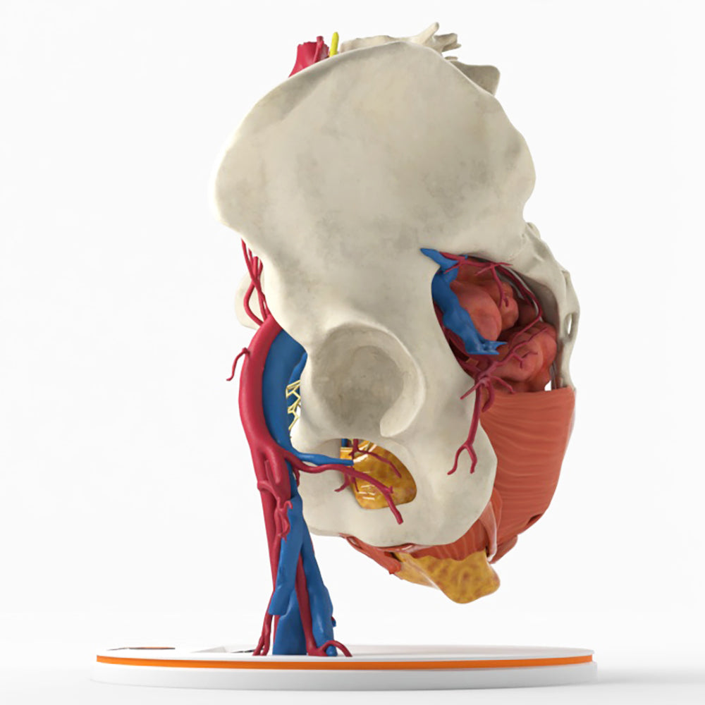 Pelvic Hernia – Female, 48 Years