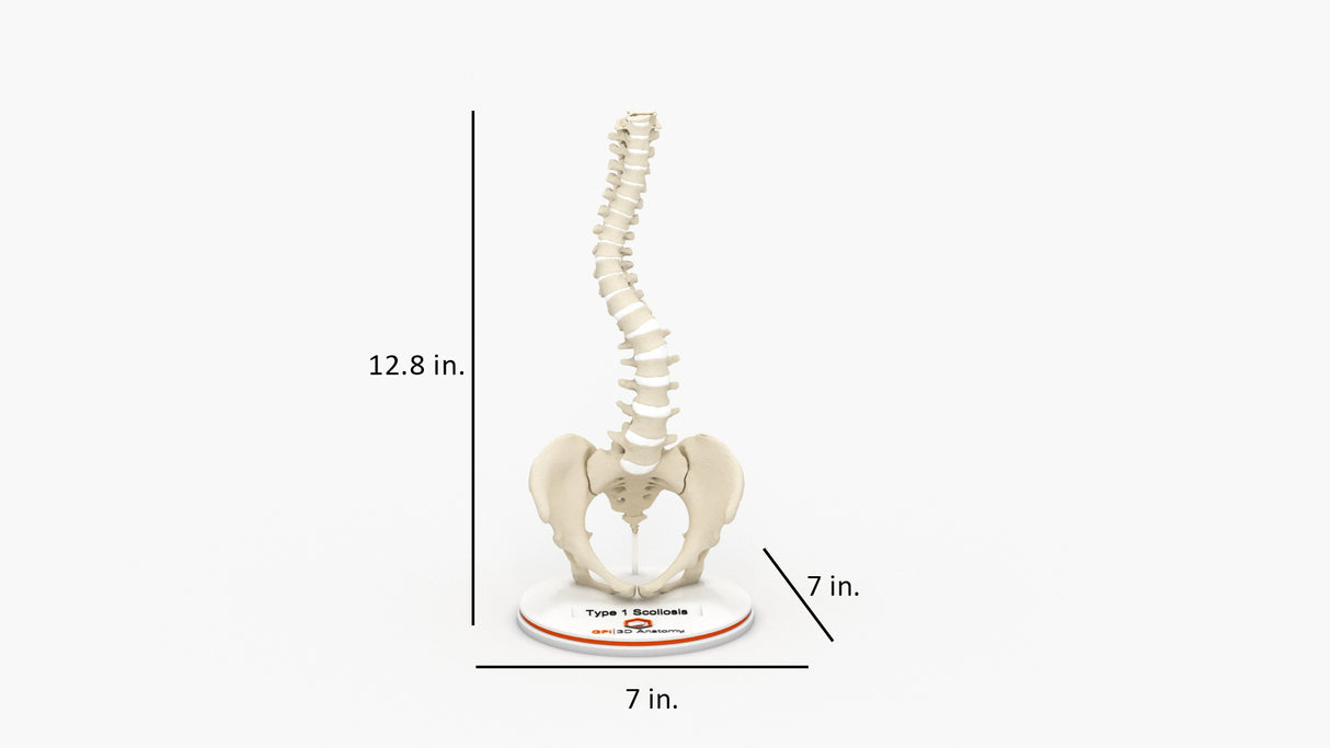 Scoliosis Type-1 Idiopathic 2