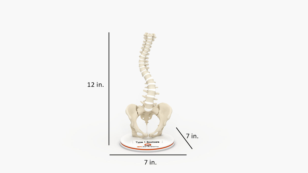 Scoliosis Type-1 Idiopathic 6