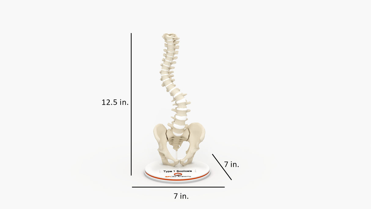Scoliosis Type-1 Idiopathic 7