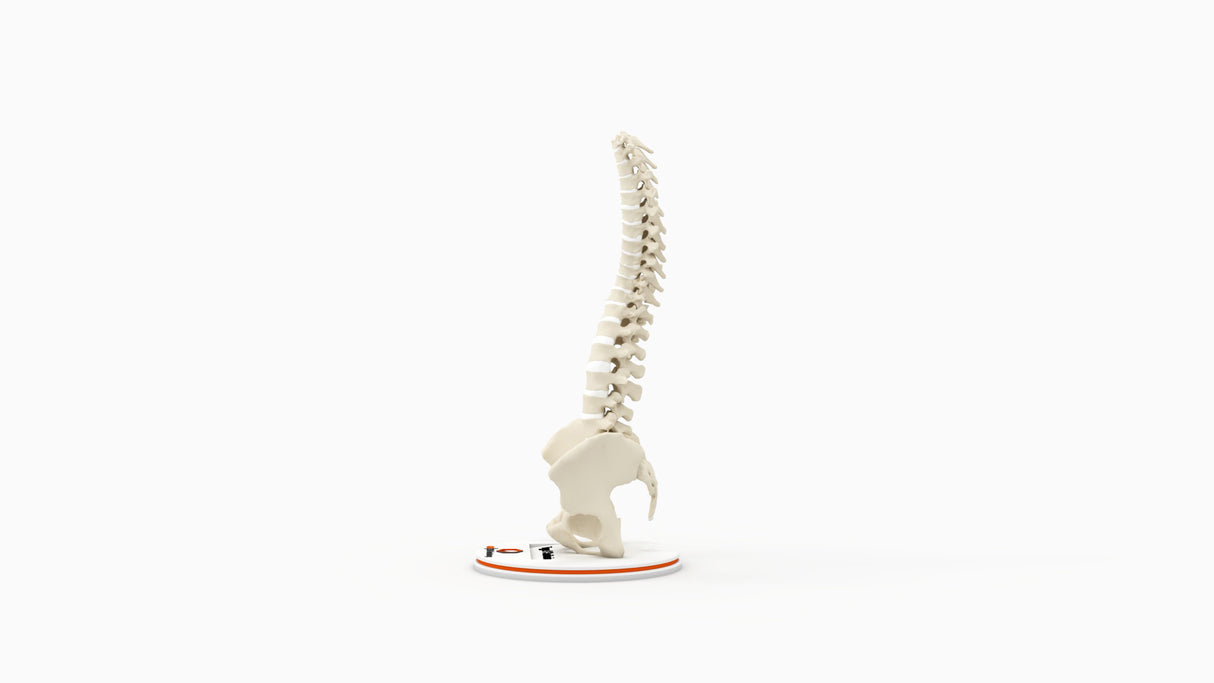 Scoliosis Type-1 Idiopathic 8