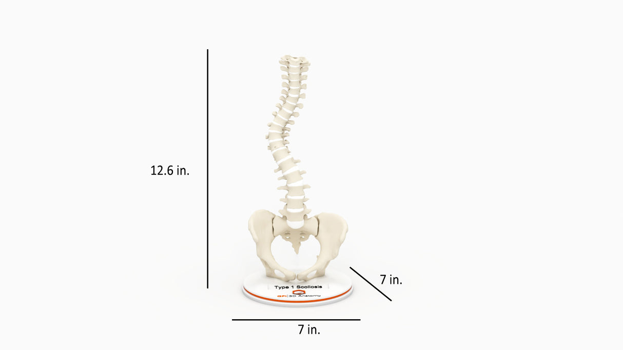 Scoliosis Type-1 Idiopathic 8