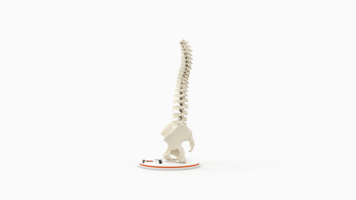 Scoliosis Type-1 Idiopathic 9