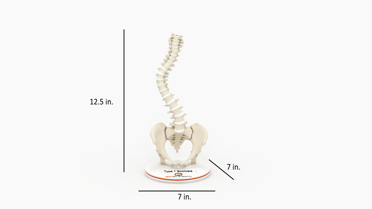 Scoliosis Type-1 Idiopathic 9