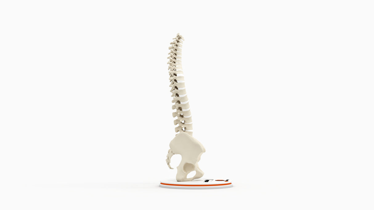 Scoliosis Type-1 Idiopathic 9