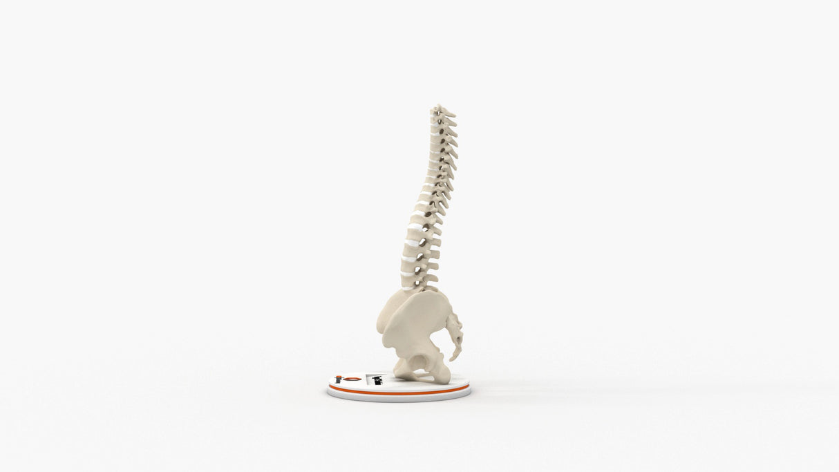Scoliosis Type-2 Model 7