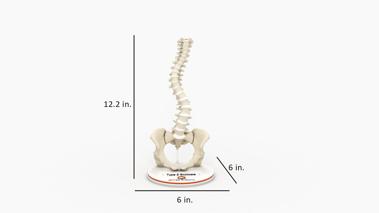 Scoliosis Type-2 Model 8