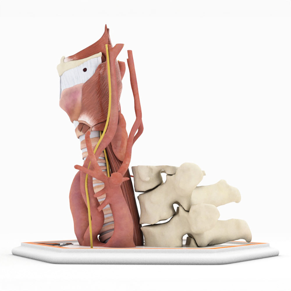 Zenker's Diverticulum (Pharyngoesophageal Diverticulum)