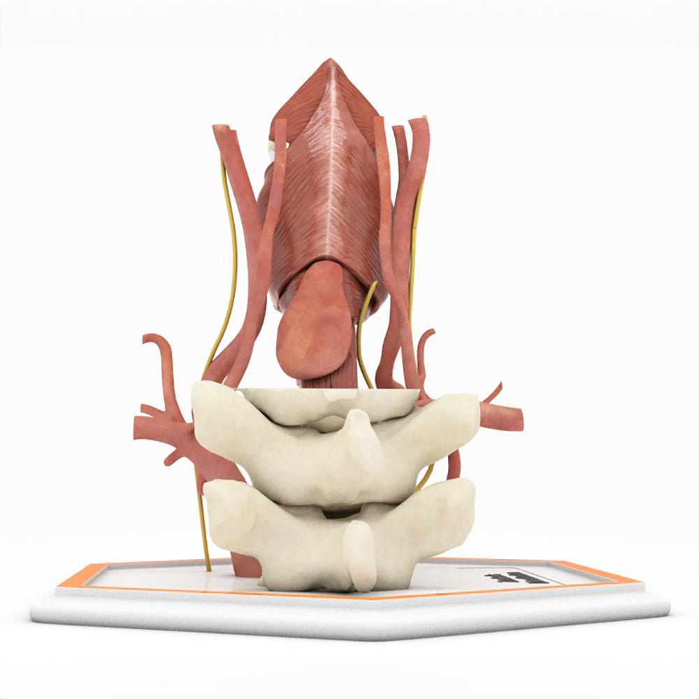 Zenker's Diverticulum (Pharyngoesophageal Diverticulum)