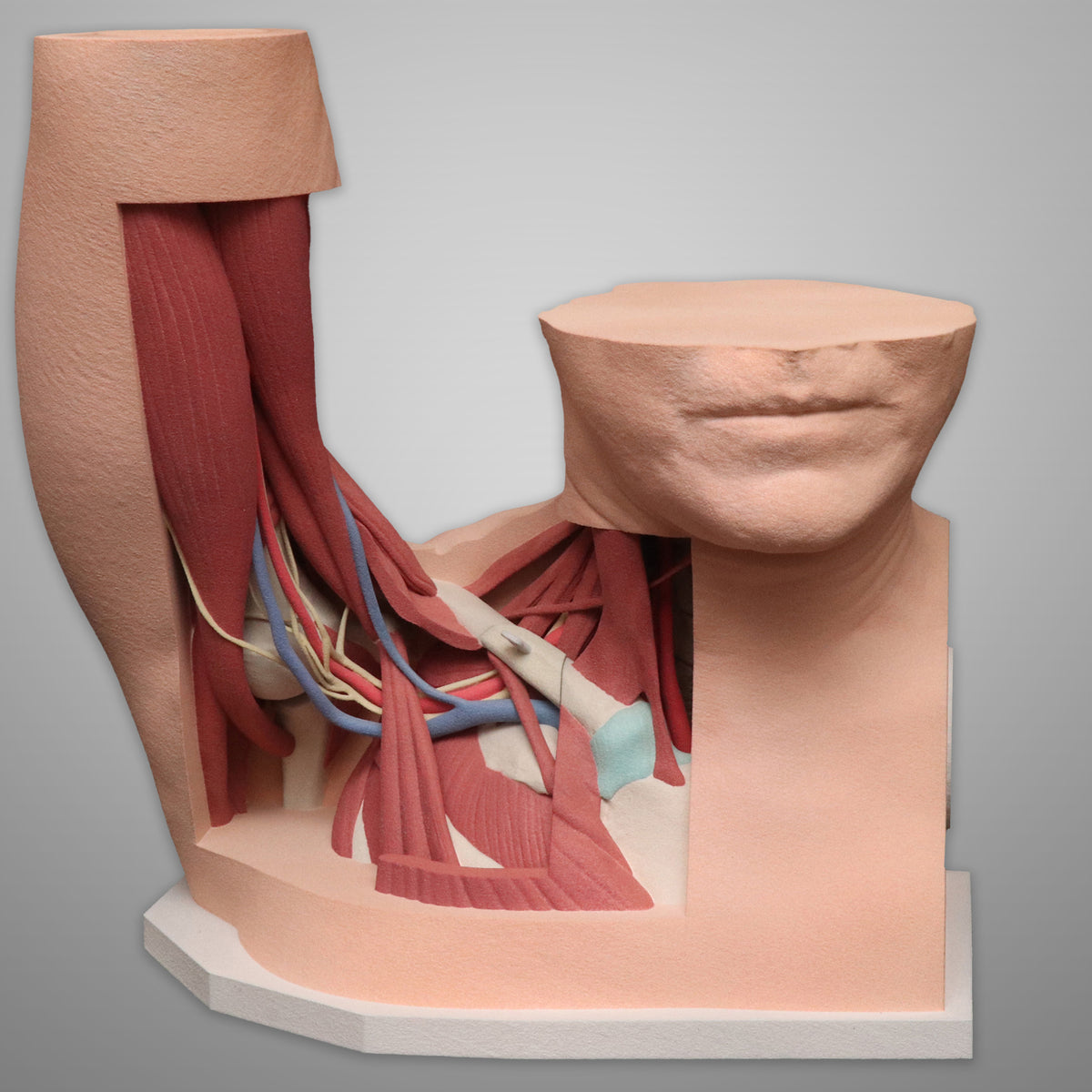 Custom 3D Anatomy Models | Thoracic Outlet Syndrome (TOS) | Thoracic ...