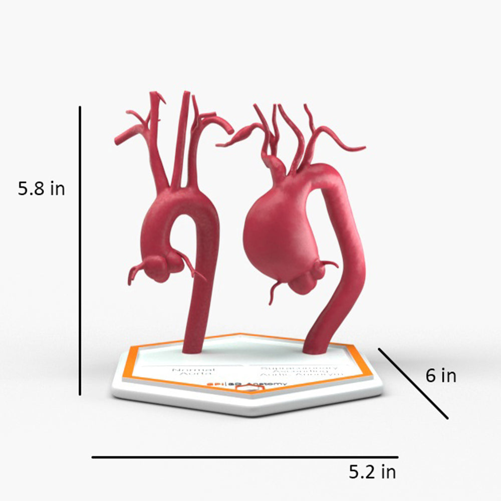 Supracoronary Ascending Aortic Aneurysm and Normal