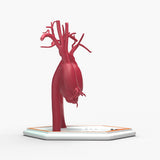 Supracoronary Ascending Aortic Aneurysm and Normal