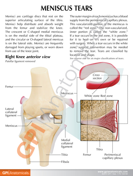 Knee Model with Meniscus Tears