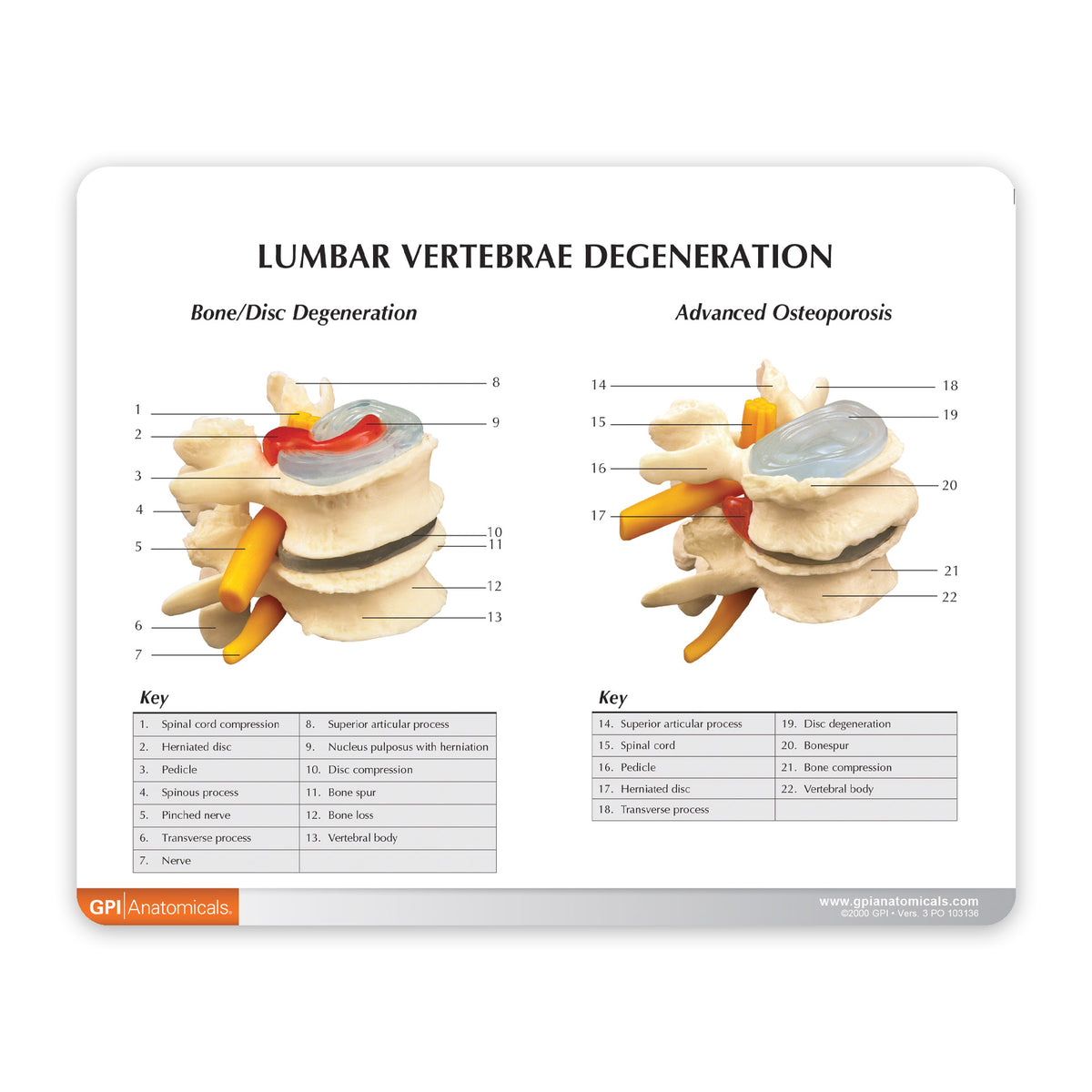4-Stage Vertebrae Model – GPI 3D Anatomy