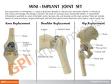 Mini Implant Joint Set