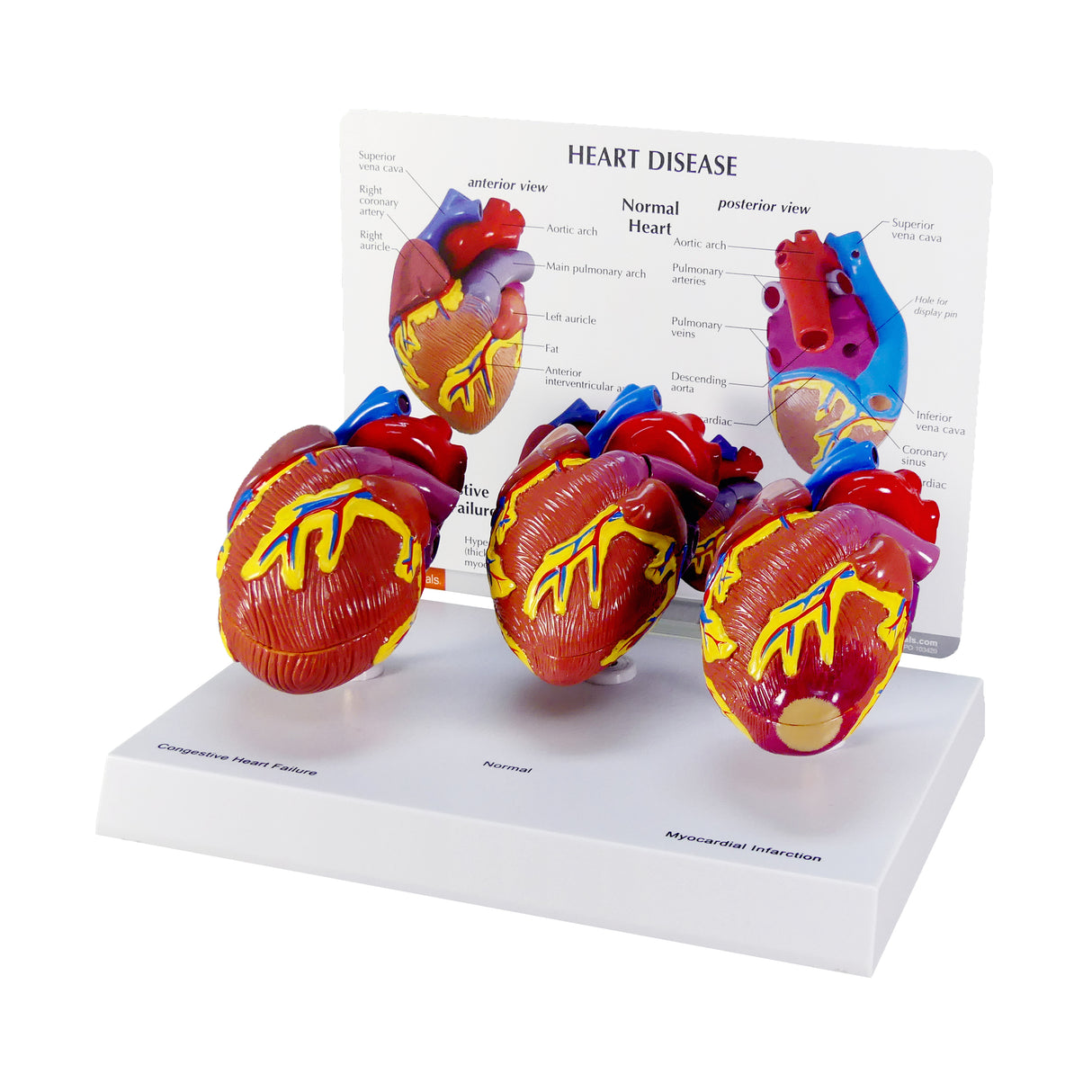 Mini Heart Instruments 3-Piece Mini Heart Model Set – GPI 3D Anatomy