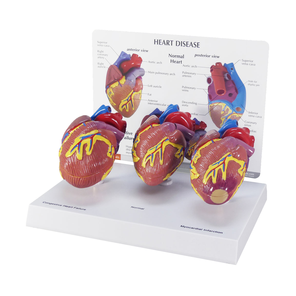 3-Piece Mini Heart Model Set