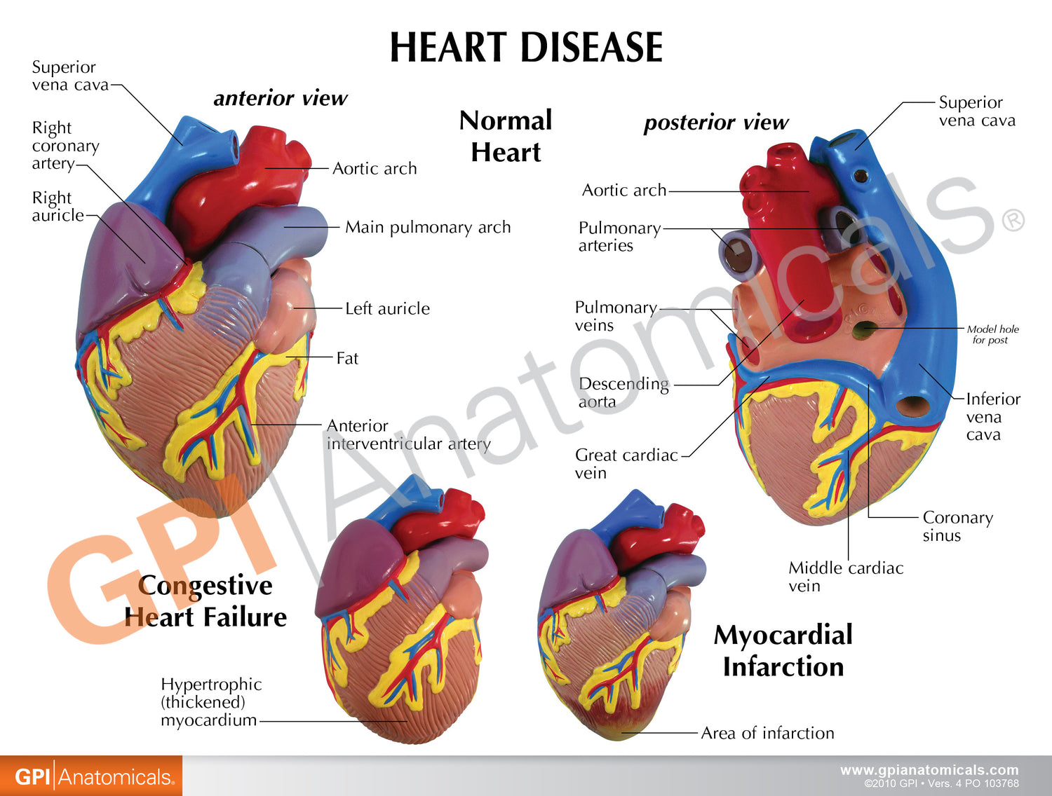 3-Piece Mini Heart Model Set – GPI 3D Anatomy