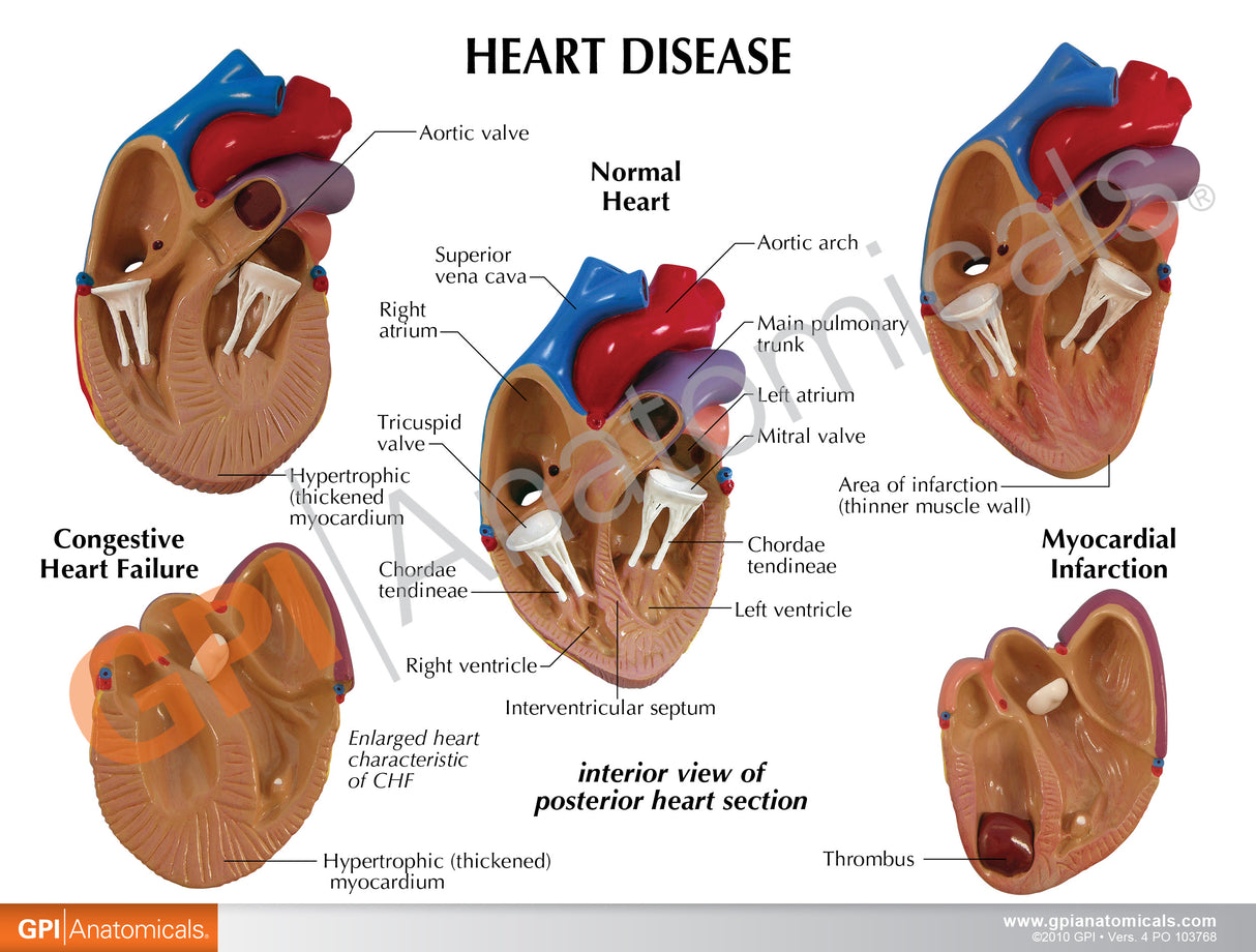 3-Piece Mini Heart Model Set