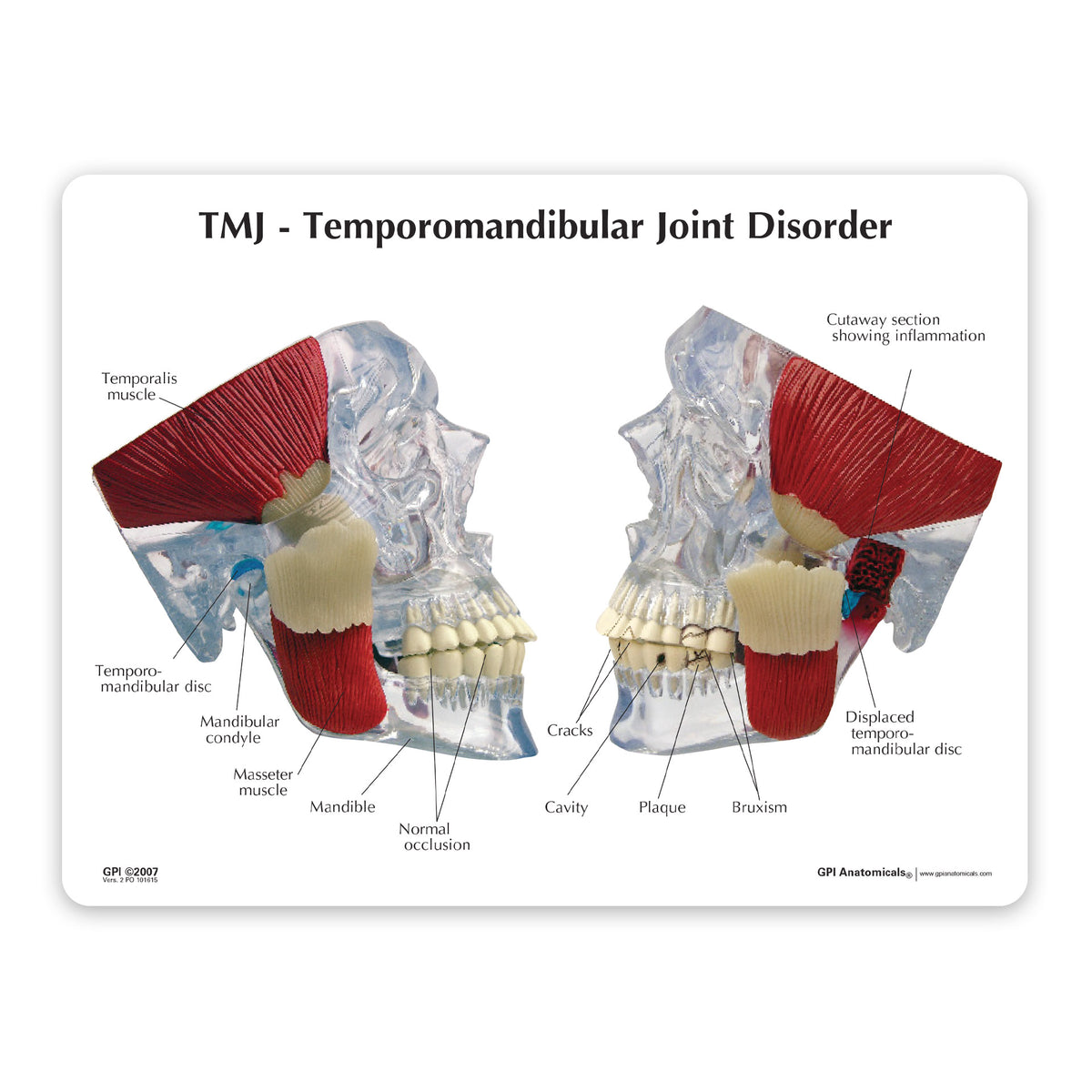 TMJ Education Card – GPI 3D Anatomy