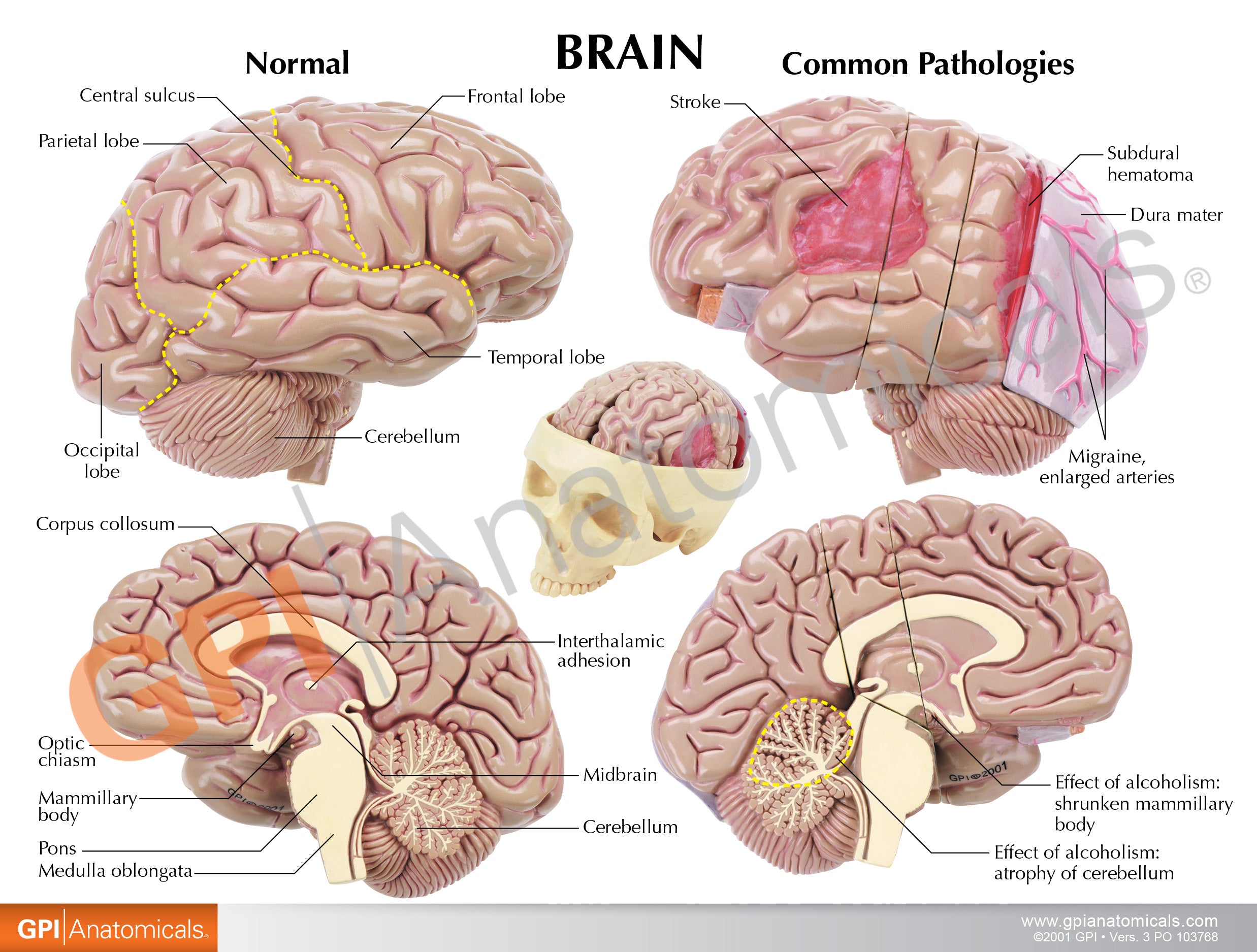 Brain with Partial Skull Model – GPI 3D Anatomy
