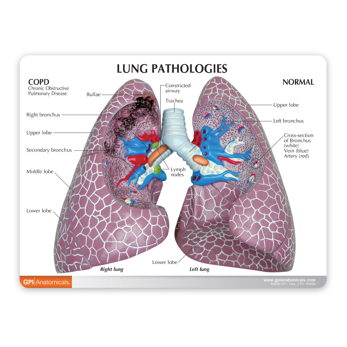 Lung Cancer Education Card – GPI 3D Anatomy