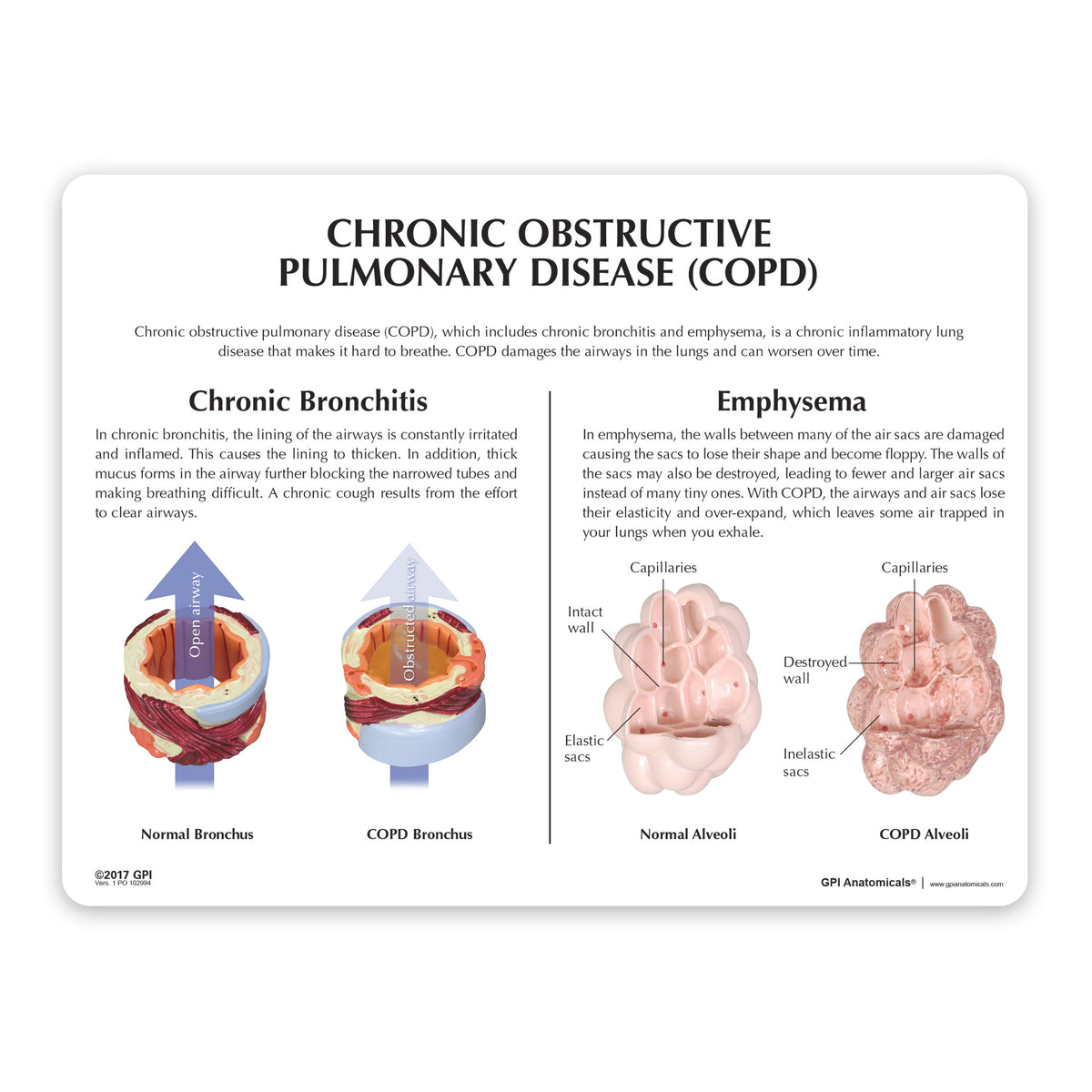 Respiratory System Model with Chronic Obstructive Pulmonary Disease (C ...