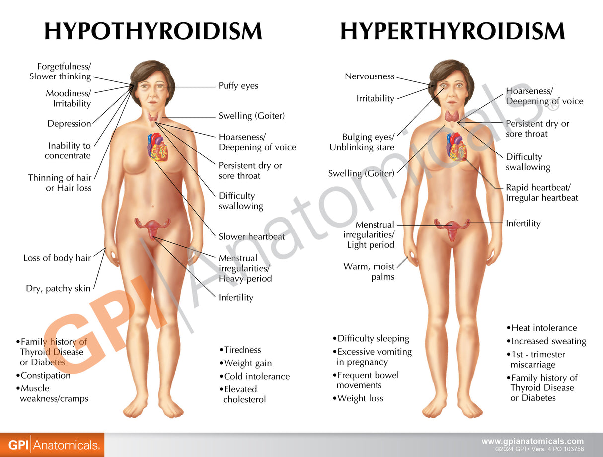 Thyroid Set Education Card