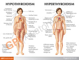 Thyroid Set Education Card