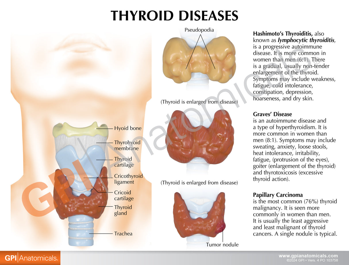 Thyroid Set Education Card