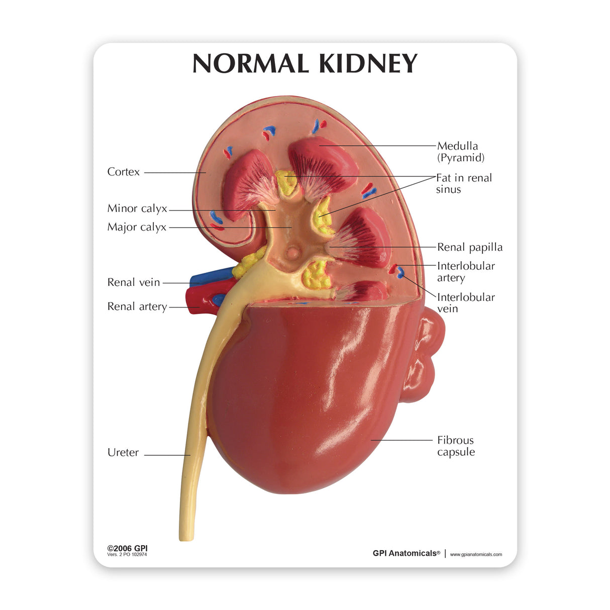 Normal and Diseased Kidney Model – GPI 3D Anatomy