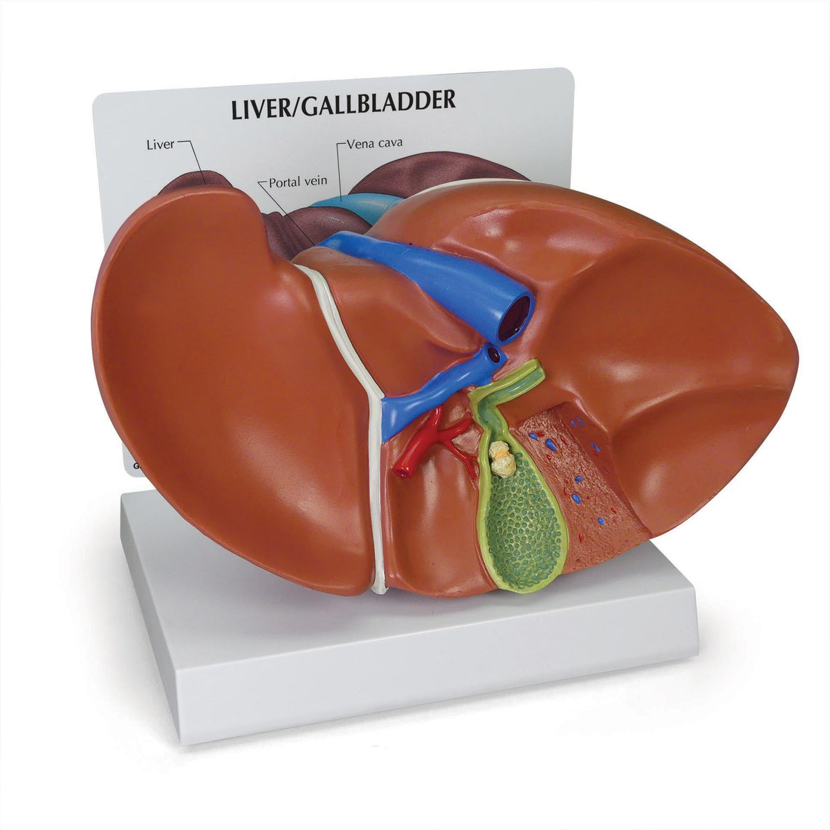 Liver and Gallbladder Model – GPI 3D Anatomy