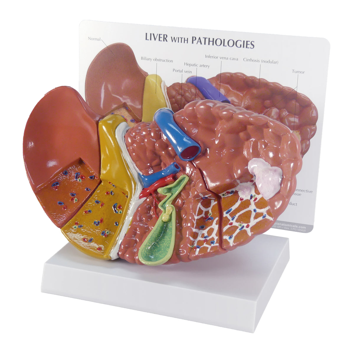 Liver Model Silicone Set (3-Pack) - Life Size Anatomy Models For ...