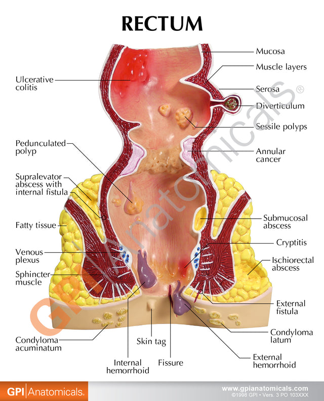 Urectum Rectum Education Card – GPI 3D Anatomy