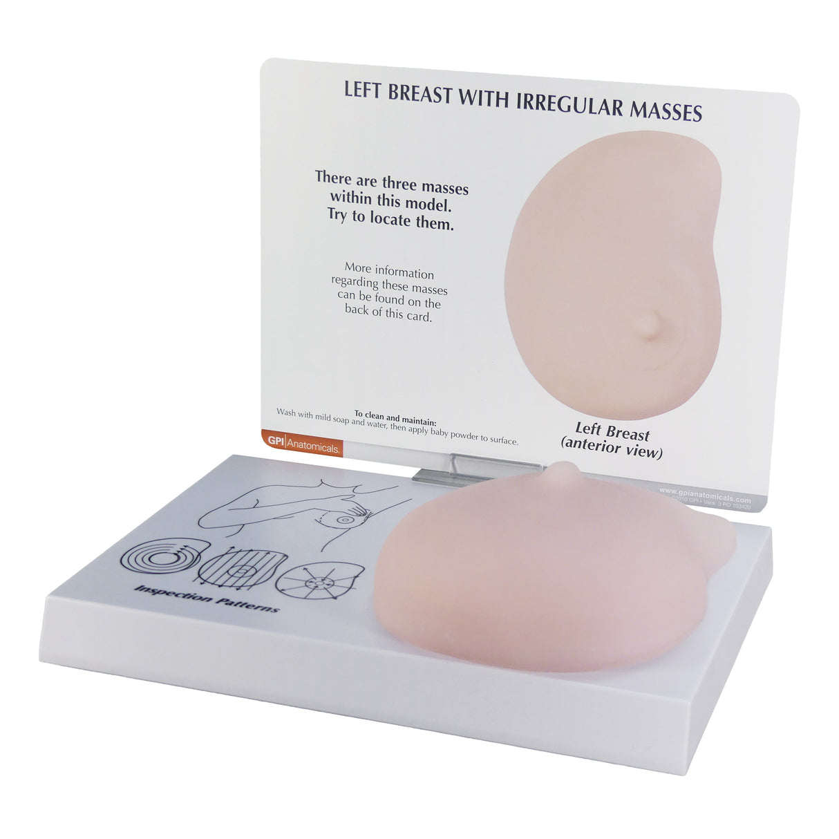 Left Breast Model with Irregular Masses