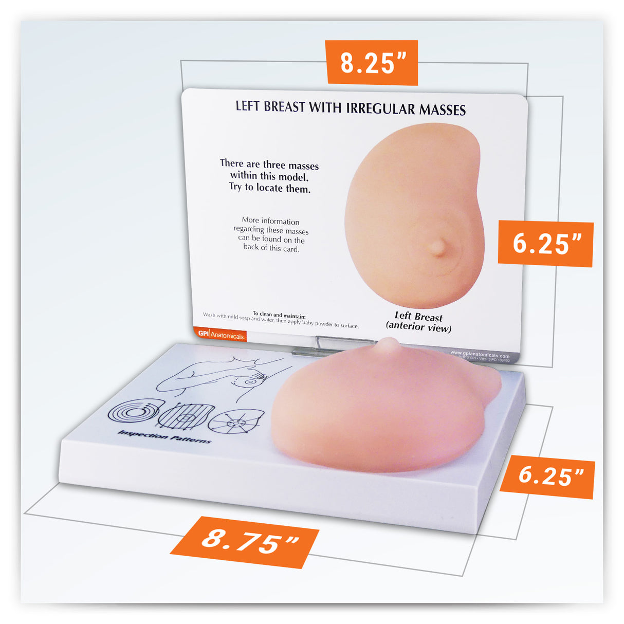 Left Breast Model with Irregular Masses