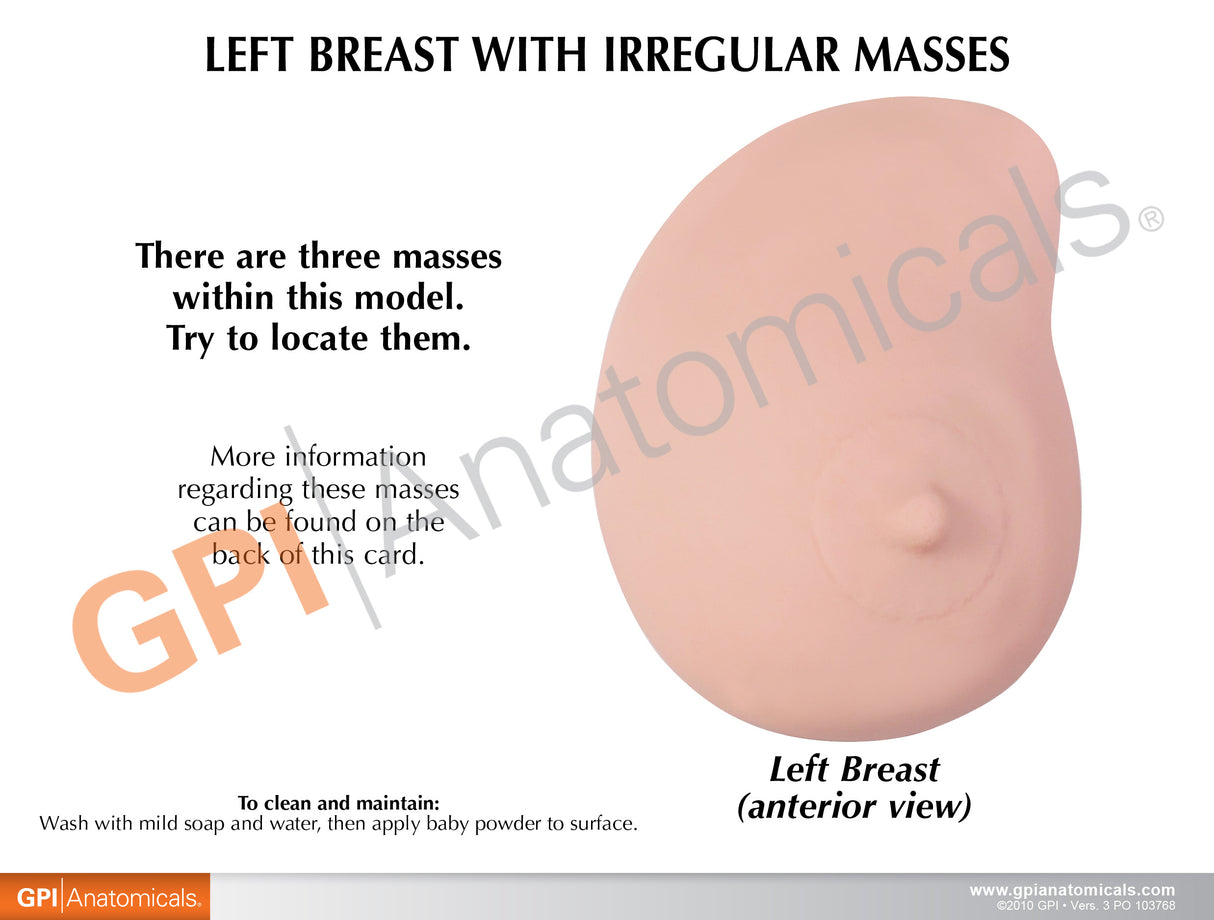 Left Breast Model with Irregular Masses