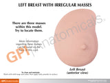 Left Breast Model with Irregular Masses