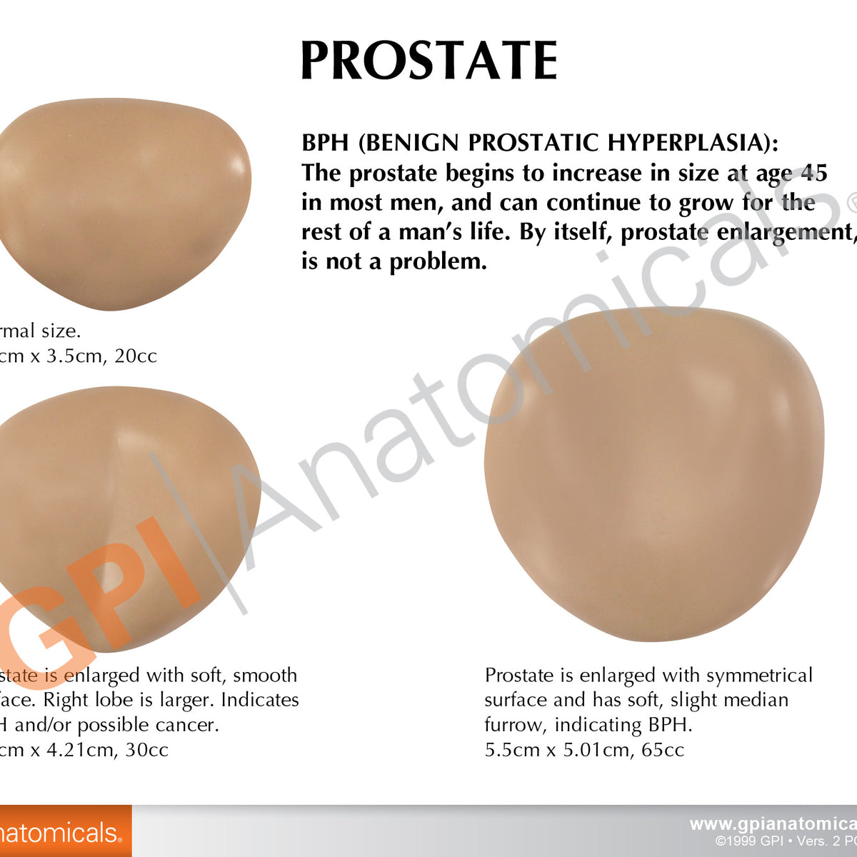 Male Pelvis with Prostate Education Card – GPI 3D Anatomy
