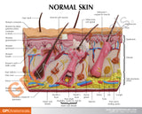 Skin Burn Model