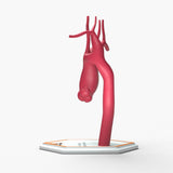 Ascending Supracoronary Aortic Aneurysm