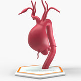 Supracoronary Ascending Aortic Aneurysm