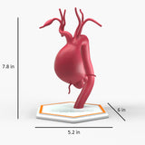 Supracoronary Ascending Aortic Aneurysm