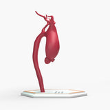Supracoronary Ascending Aortic Aneurysm Left Carotid Variant
