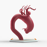 Ascending Supracoronary Aortic Arch and Innominate Artery Aneurysm