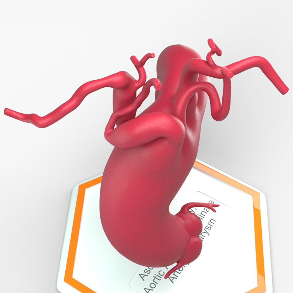 Ascending Supracoronary Aortic Arch and Innominate Artery Aneurysm