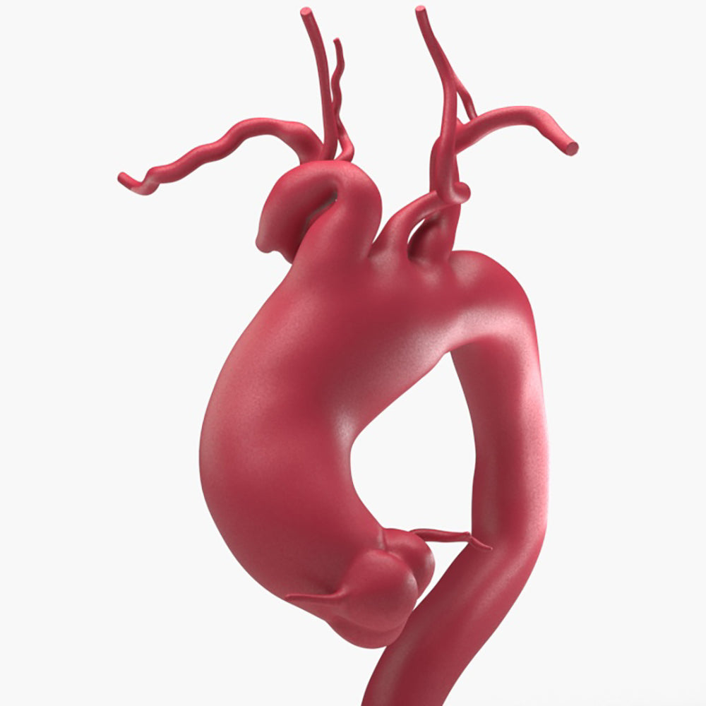 Ascending Supracoronary Aortic Arch and Innominate Artery Aneurysm