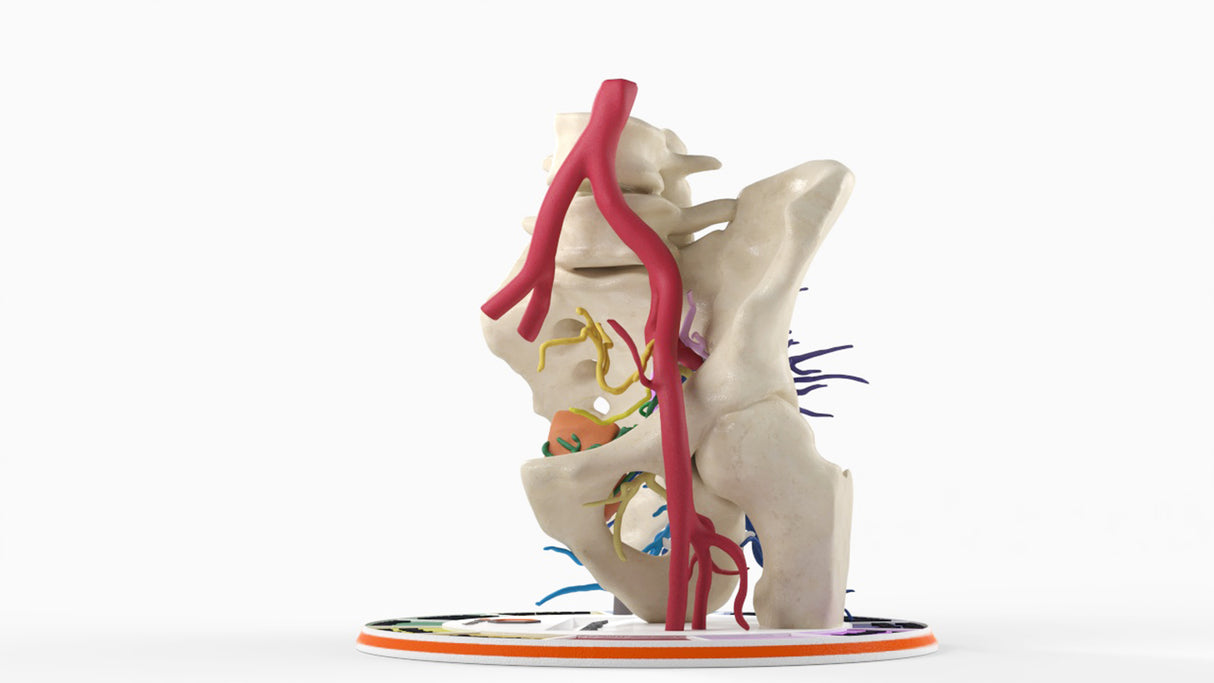 Internal Iliac Arteries - Male, 81 Years