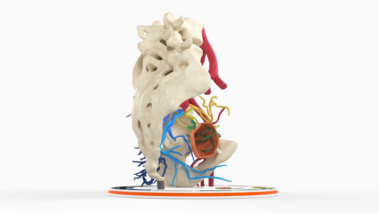 Internal Iliac Arteries - Male, 81 Years