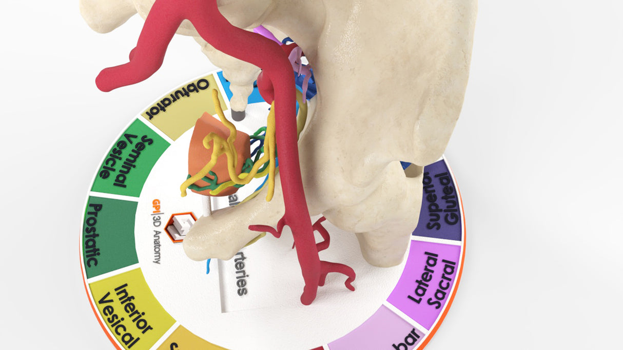 Internal Iliac Arteries - Male, 81 Years